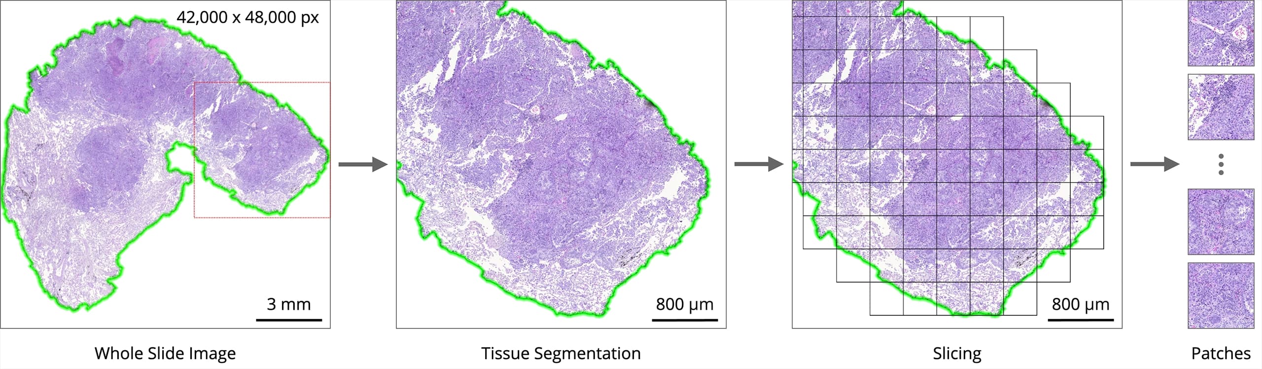 WSI Slicing Workflow