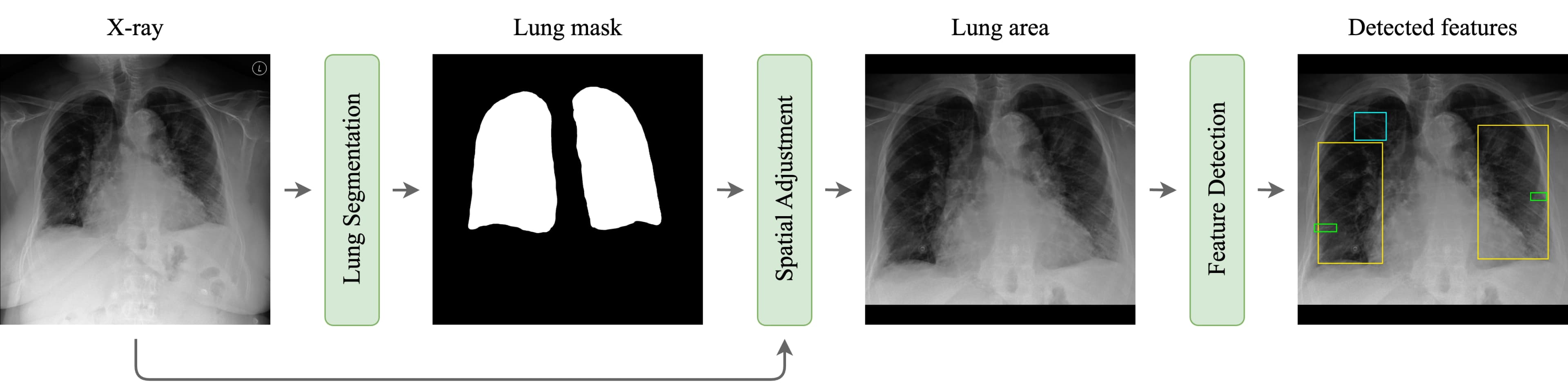 Feature Detection Workflow