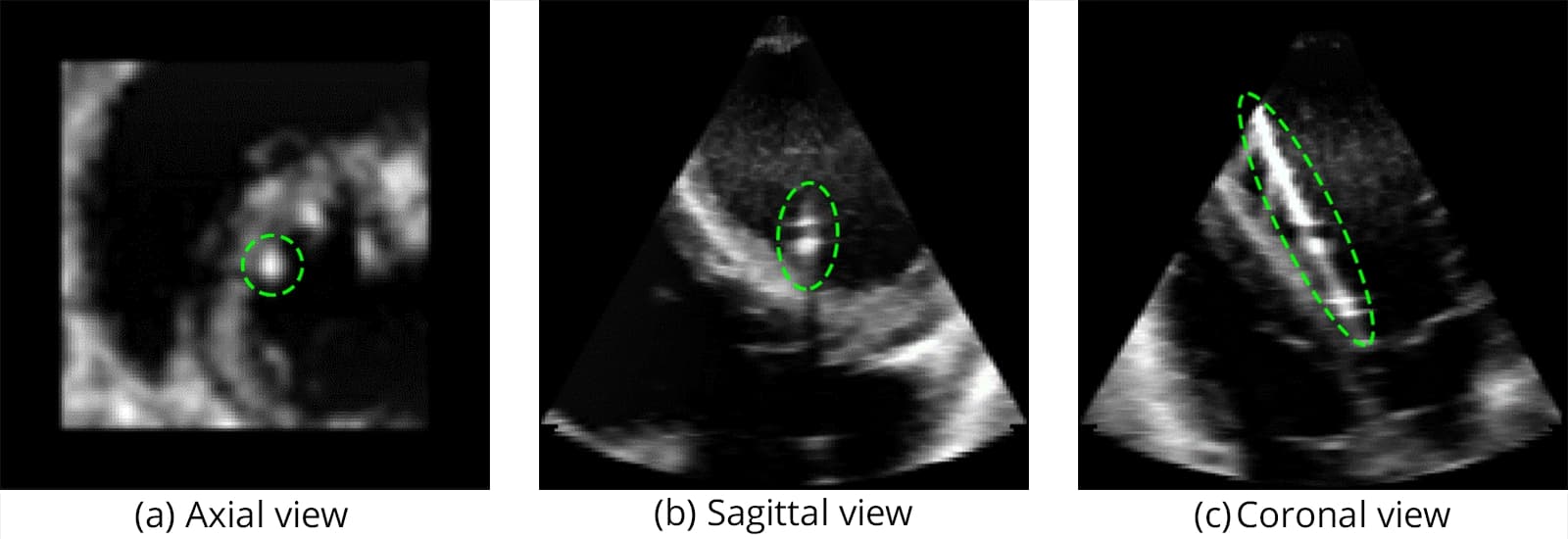 Catheter Source Data