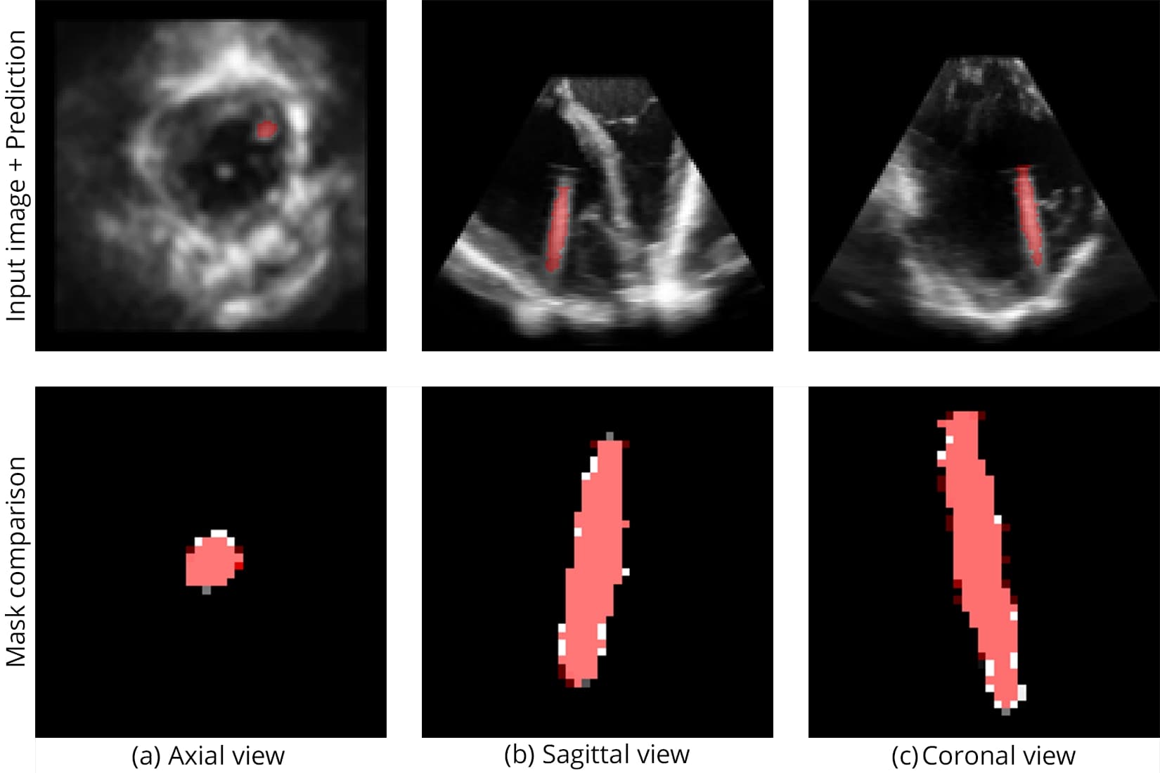 Segmentation of Real Sample