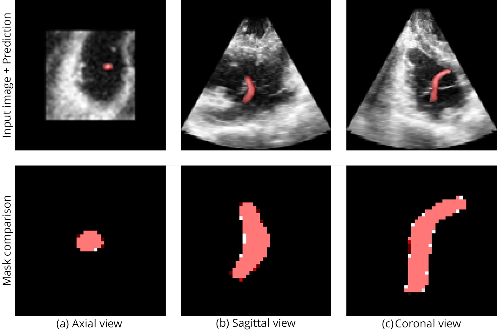 Segmentation of Synthetic Sample